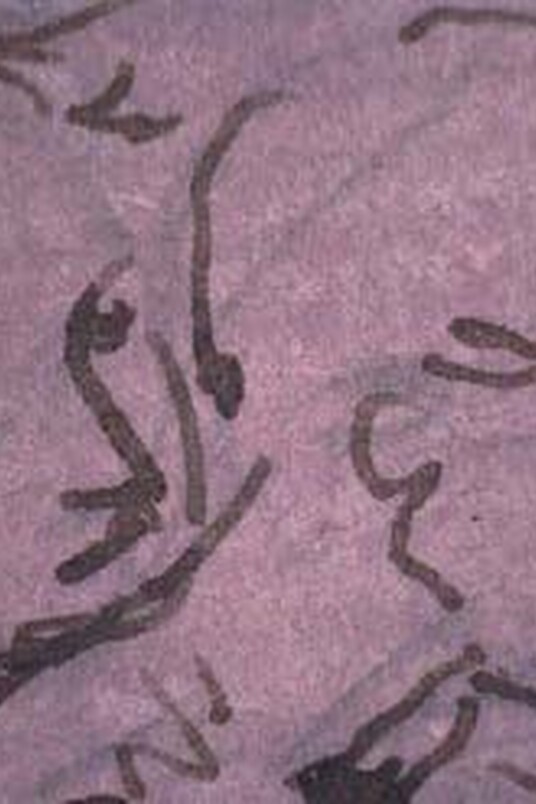 Leonardo da Vinci, »Studien zur Anbetung der Hirten« (Detail) Inv. Nr. 21488